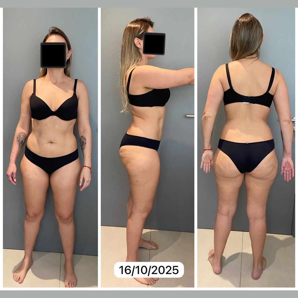 Aluna do Barriga Detox — registro de antes, 16 de outubro de 2025