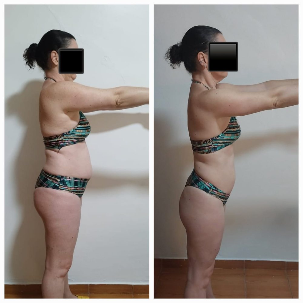 Antes e depois de aluna do Barriga Detox — vista de perfil